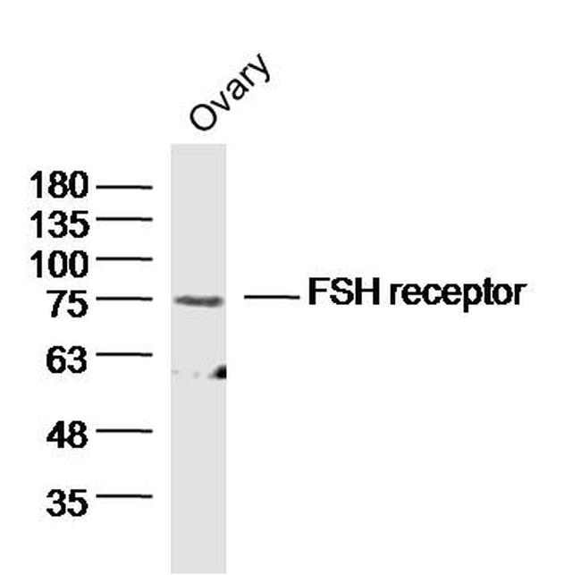 FSH Receptor Antibody in Western Blot (WB)