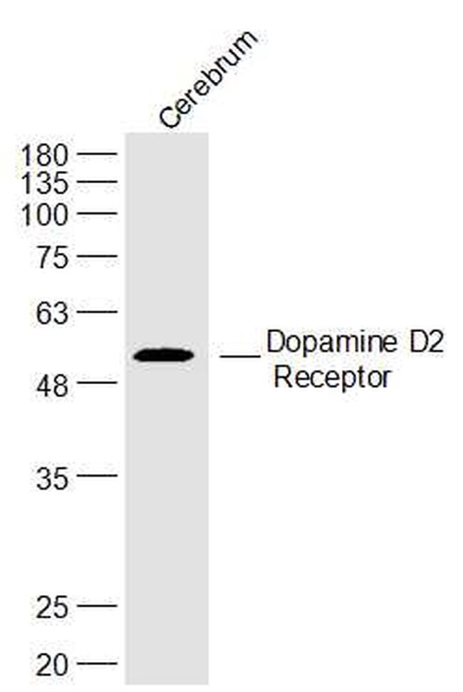 Dopamine D2 Receptor Antibody in Western Blot (WB)