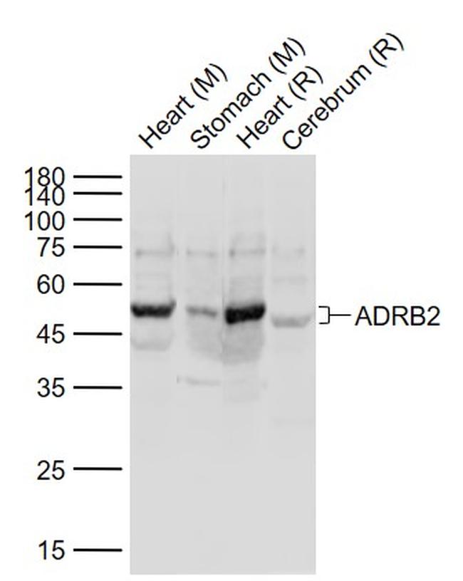 ADRB2 Antibody in Western Blot (WB)