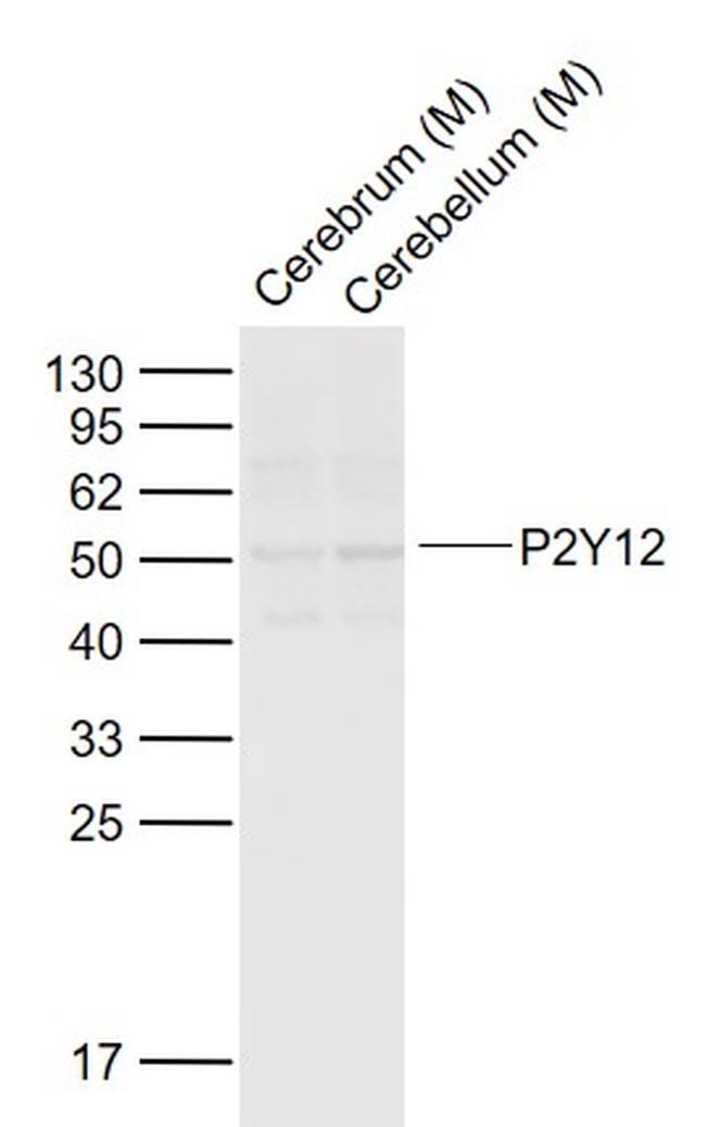 P2Y12 Antibody in Western Blot (WB)