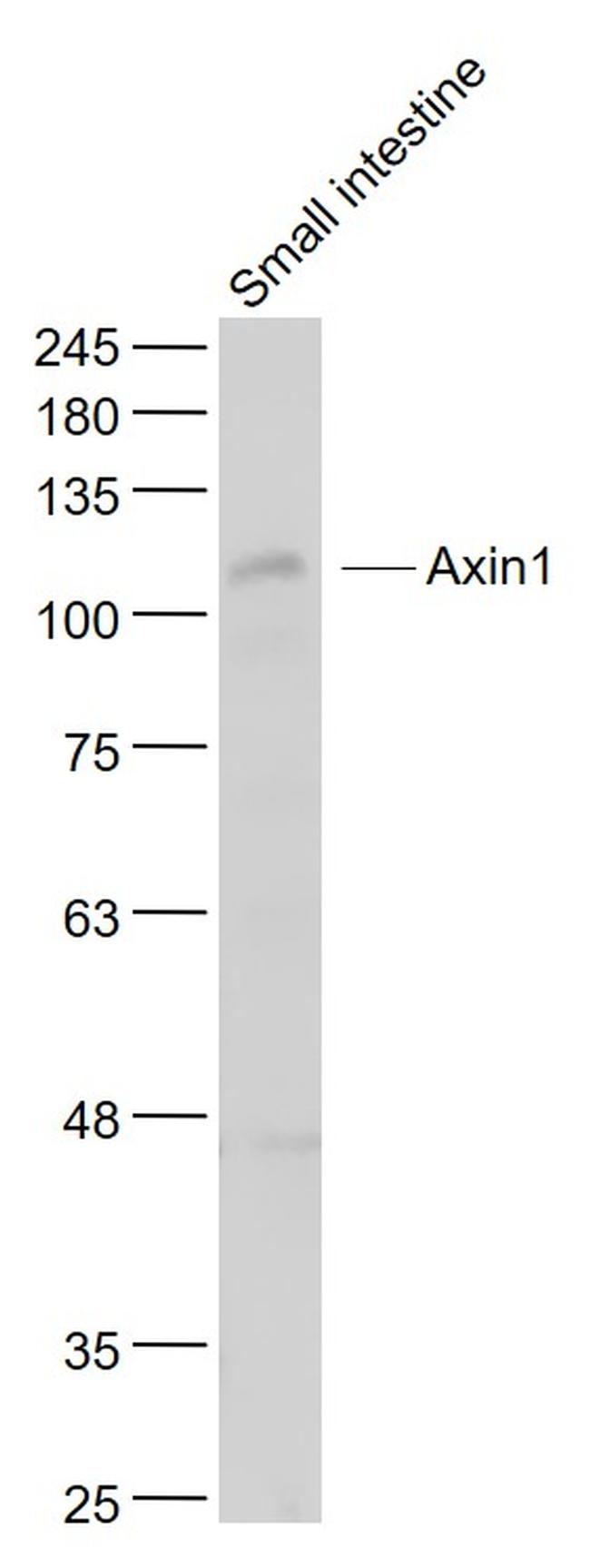 Axin1 Antibody in Western Blot (WB)