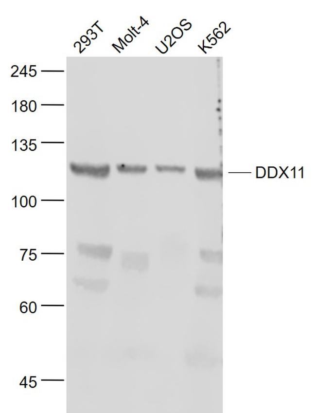 KRG2/DDX11 Antibody in Western Blot (WB)
