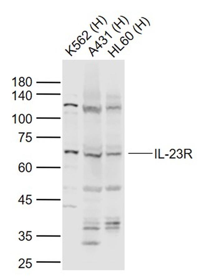 IL-23R Antibody in Western Blot (WB)