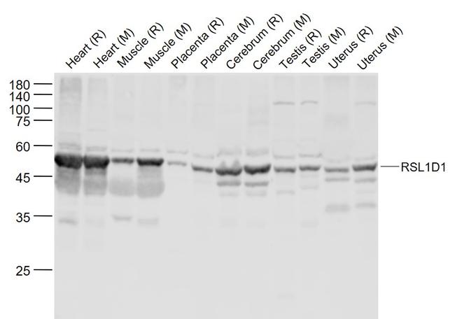 RSL1D1 Antibody in Western Blot (WB)