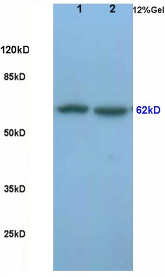 Frizzled 5/8 Antibody in Western Blot (WB)