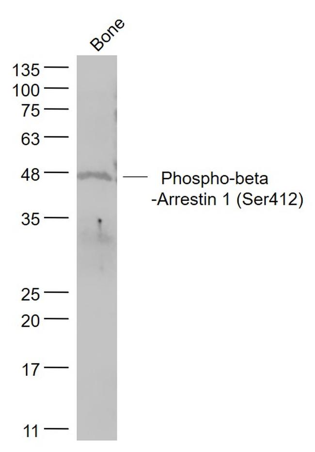 Phospho-beta Arrestin 1Ser412 (Ser412) Antibody in Western Blot (WB)
