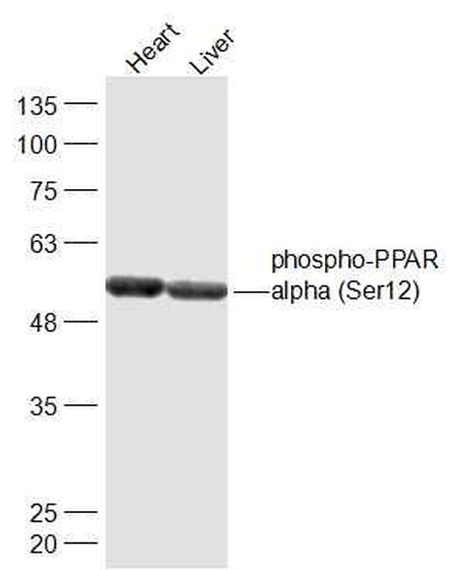 Phospho-PPAR alpha (Ser12) Antibody in Western Blot (WB)