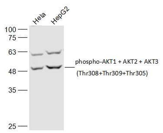 Phospho-AKT1/2/3 (Thr305, Thr308, Thr309) Antibody in Western Blot (WB)