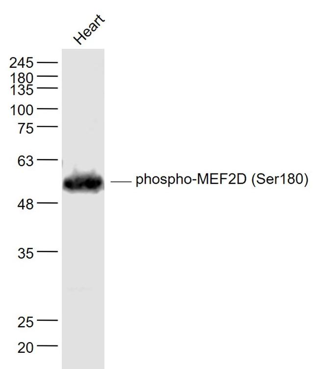 Phospho-MEF2D (Ser180) Antibody in Western Blot (WB)