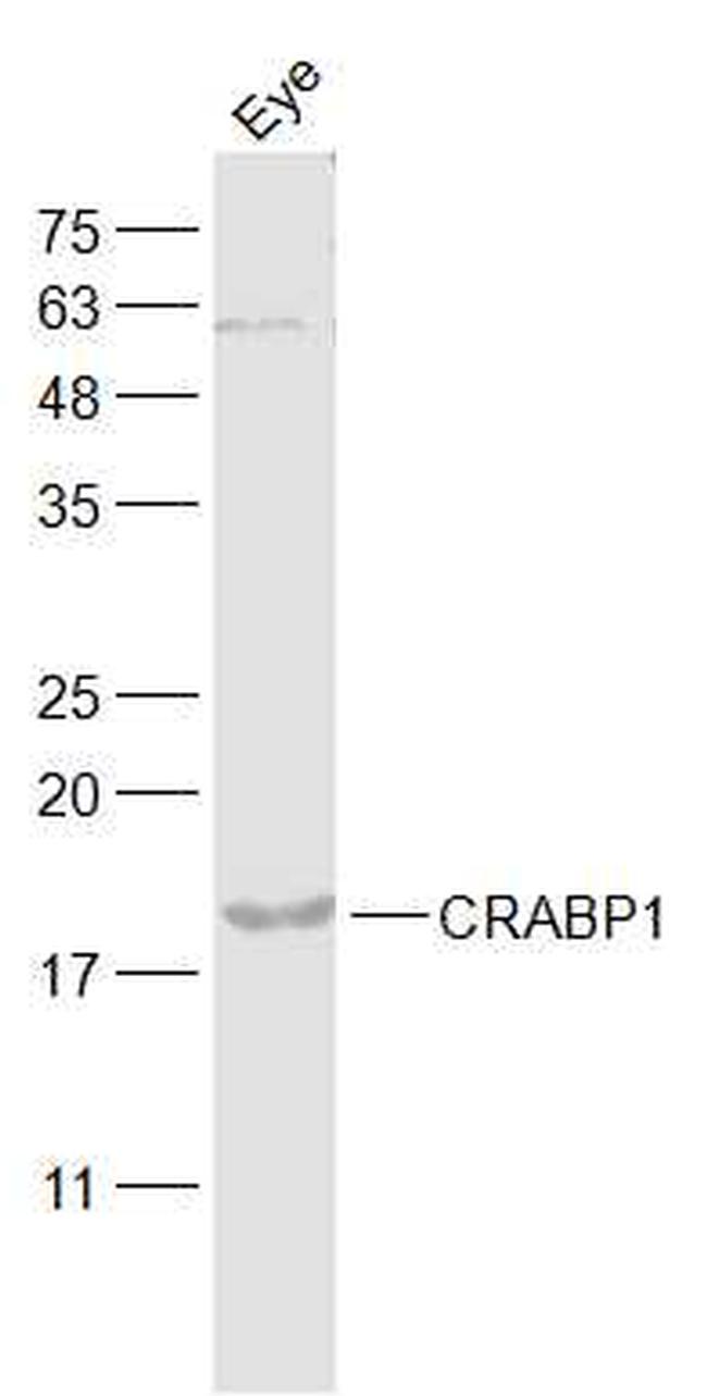 Retinol Binding Protein Antibody in Western Blot (WB)