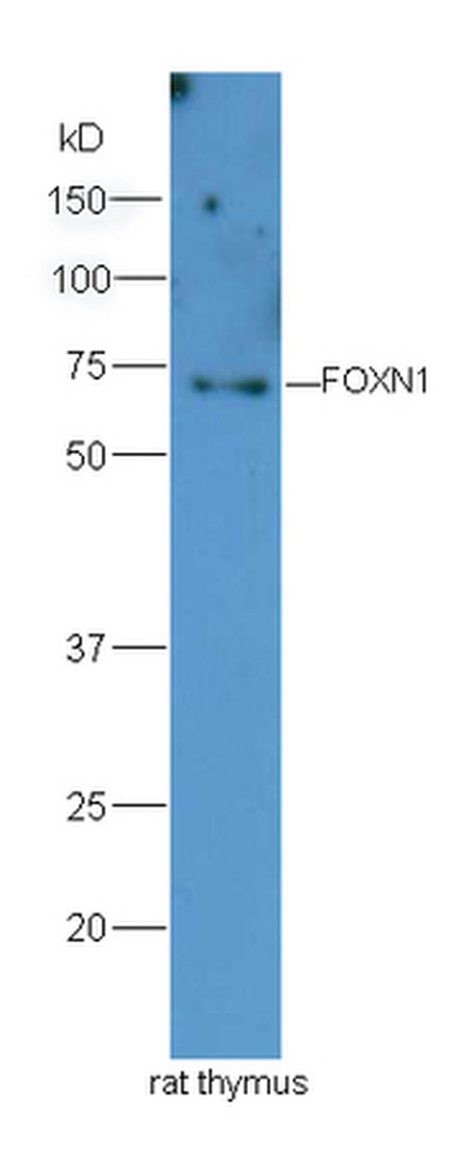 FOXN1 Antibody in Western Blot (WB)