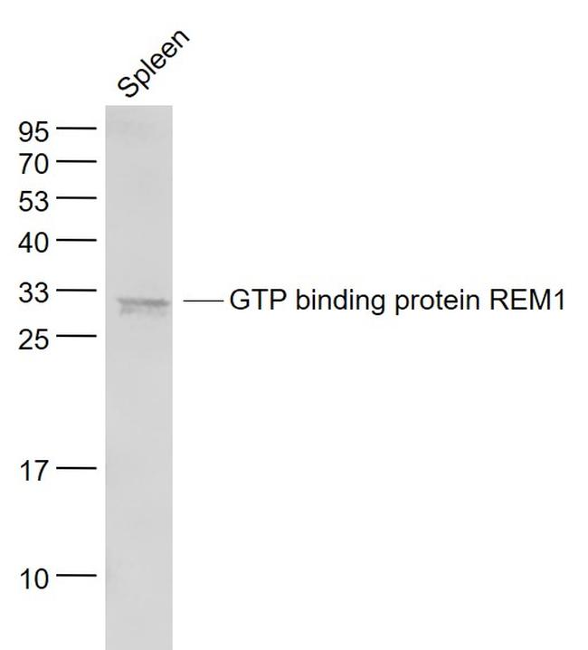 GTP binding protein REM1 Antibody in Western Blot (WB)