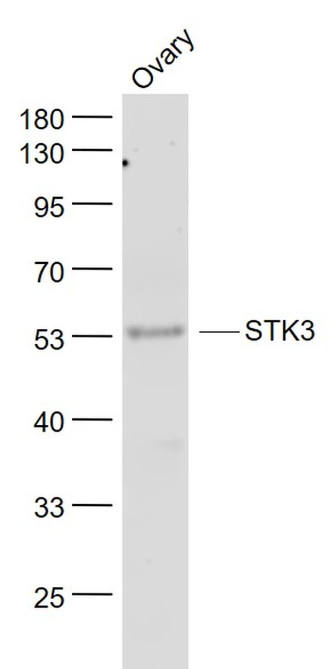 STK3+STK4 Antibody in Western Blot (WB)