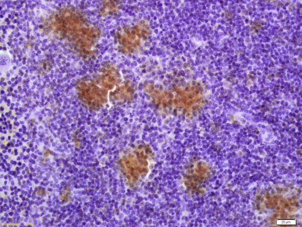TXNRD1 Antibody in Immunohistochemistry (Paraffin) (IHC (P))