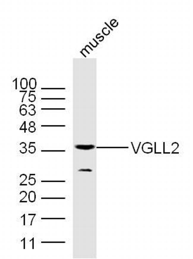 VGLL2 Antibody in Western Blot (WB)
