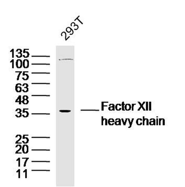 Factor 12 heavy chain Antibody in Western Blot (WB)