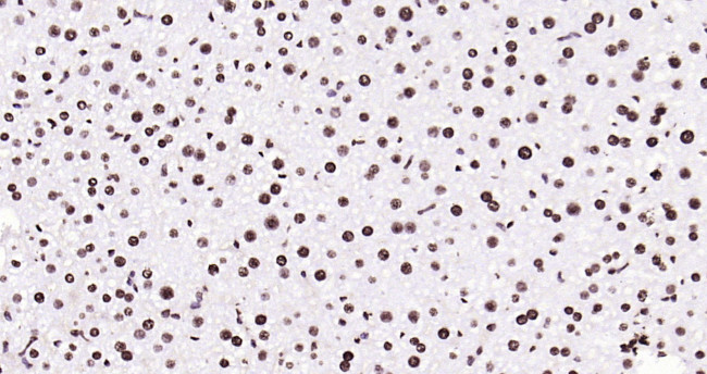 Histone H3 (tri methyl K79) Antibody in Immunohistochemistry (Paraffin) (IHC (P))