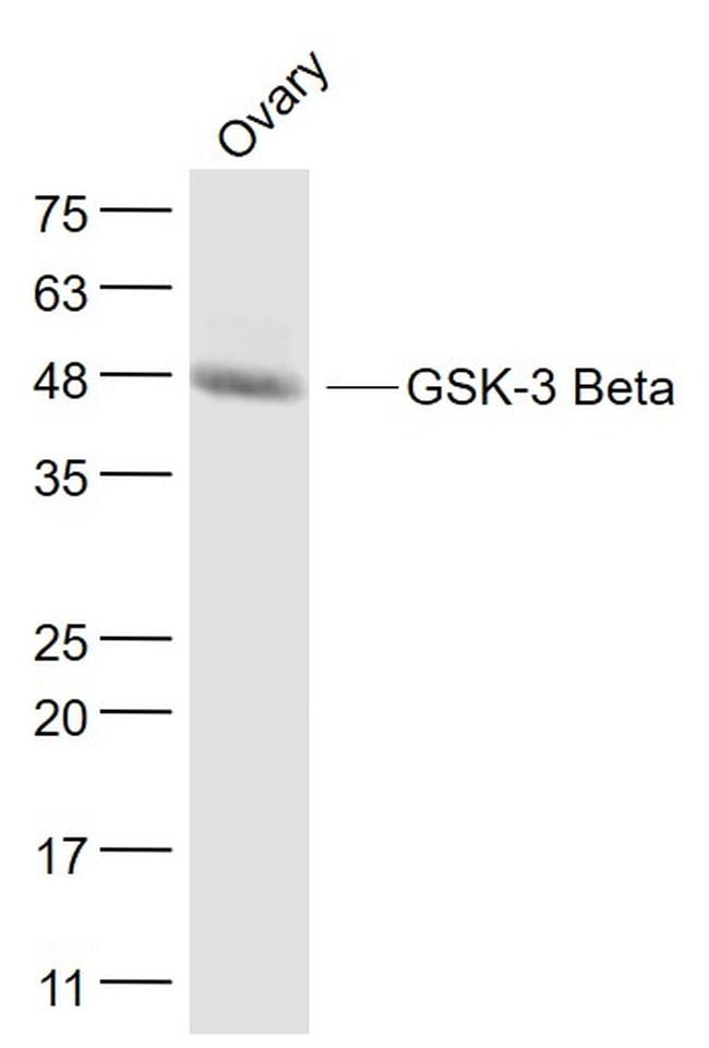 GSK-3 Beta Antibody in Western Blot (WB)