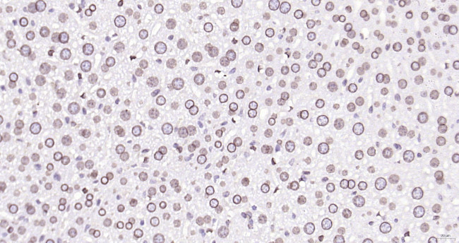 Lamin A/C Antibody in Immunohistochemistry (Paraffin) (IHC (P))