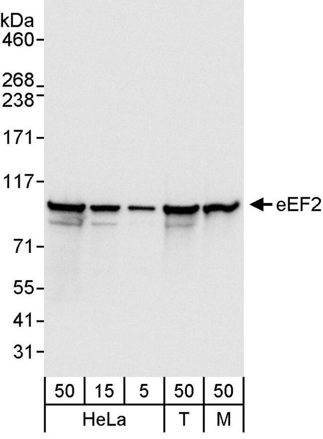 eEF2 Antibody in Western Blot (WB)
