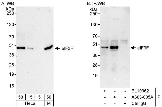 eIF3F Antibody in Western Blot (WB)