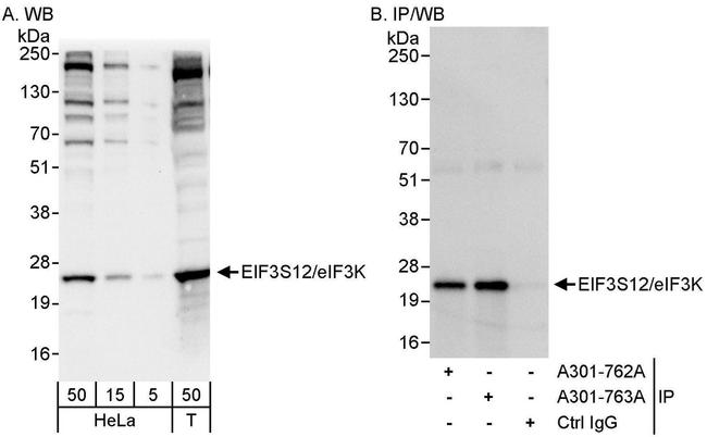eIF3K/EIF3S12 Antibody in Western Blot (WB)