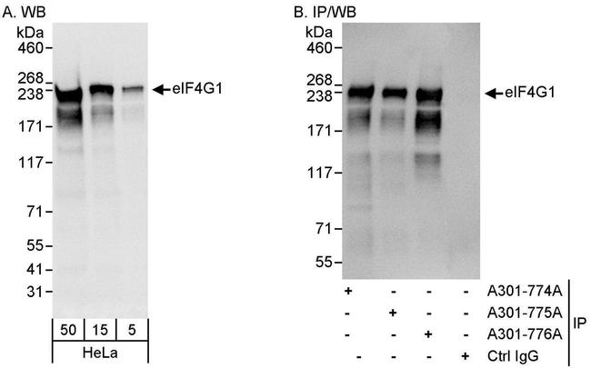eIF4G1/eIF4GI Antibody in Western Blot (WB)