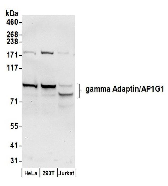 gamma Adaptin/AP1G1 Antibody in Western Blot (WB)