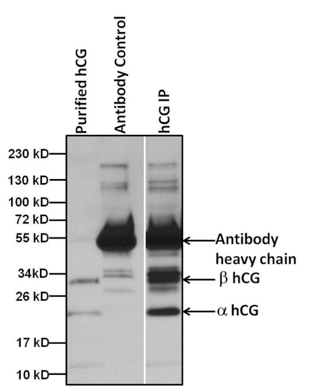 hCG Antibody in Immunoprecipitation (IP)