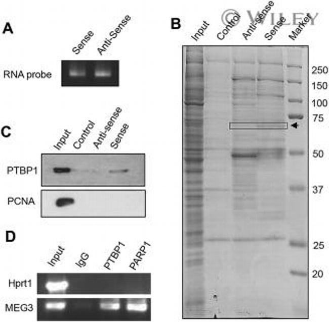 PTBP1 Antibody in Western Blot, Immunoprecipitation (WB, IP)