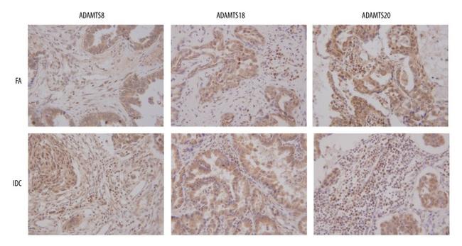 ADAMTS8 Antibody in Immunohistochemistry (IHC)