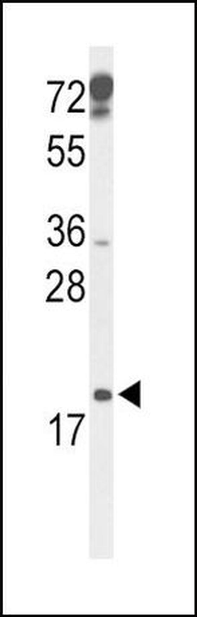 p19 INK4d Antibody in Western Blot (WB)