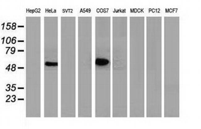 p53 Antibody in Western Blot (WB)