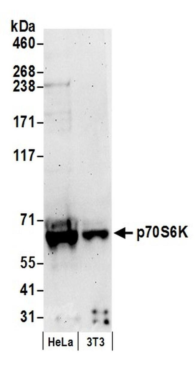 p70S6K Antibody in Western Blot (WB)