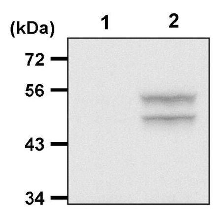 Phospho-JNK1/JNK2 (Thr183, Tyr185) Antibody in Immunoprecipitation (IP)