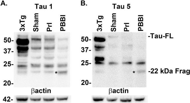 Tau (Cleaved Asp421, Asp422) Antibody in Western Blot (WB)