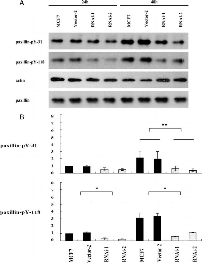 Phospho-Paxillin (Tyr31) Antibody in Western Blot (WB)
