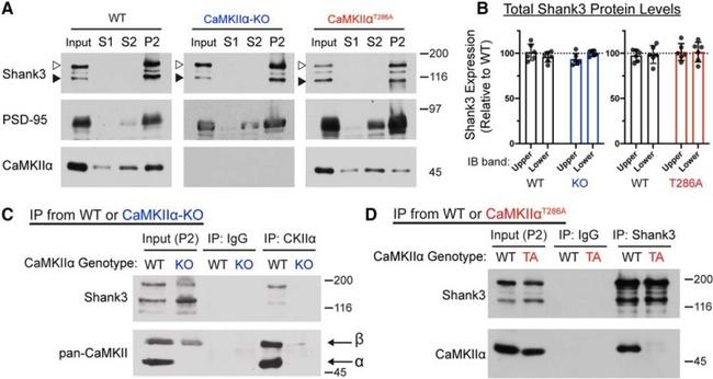 CaMKII alpha Antibody in Western Blot, Immunoprecipitation (WB, IP)