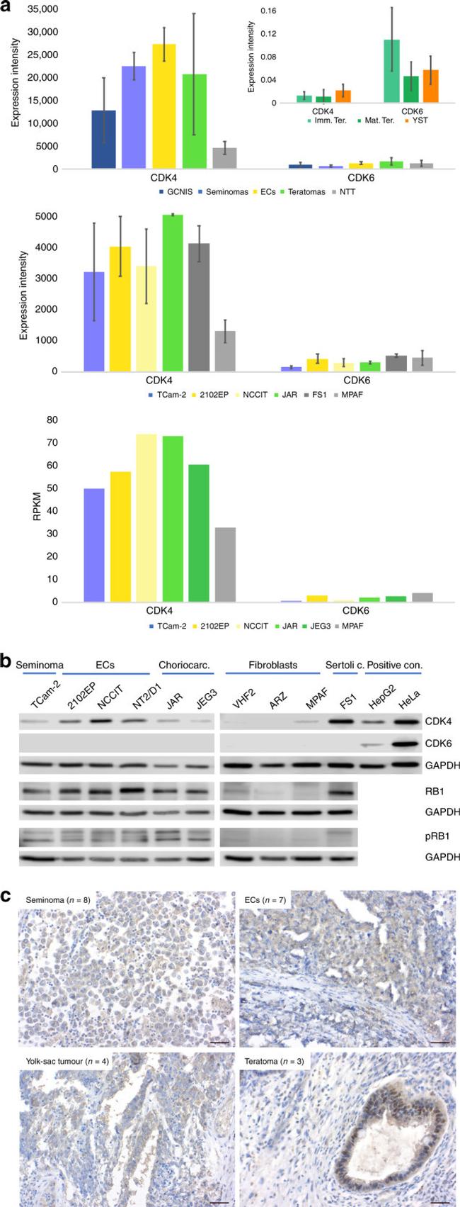 CDK4 Antibody in Immunohistochemistry (IHC)