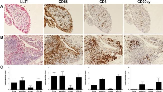 CD68 Antibody in Immunohistochemistry (IHC)