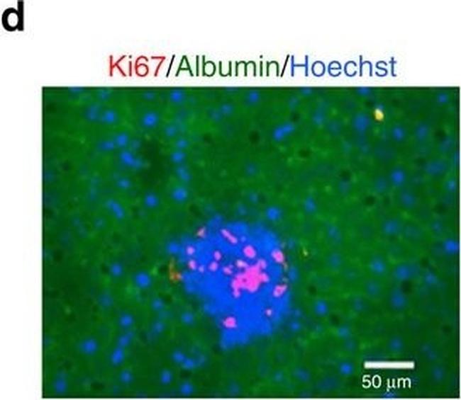 Rabbit IgG (H+L) Cross-Adsorbed Secondary Antibody in Immunohistochemistry (IHC)