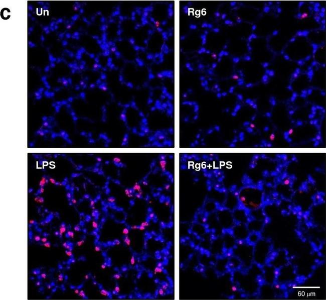 Rat IgG (H+L) Cross-Adsorbed Secondary Antibody in Immunohistochemistry (Paraffin) (IHC (P))