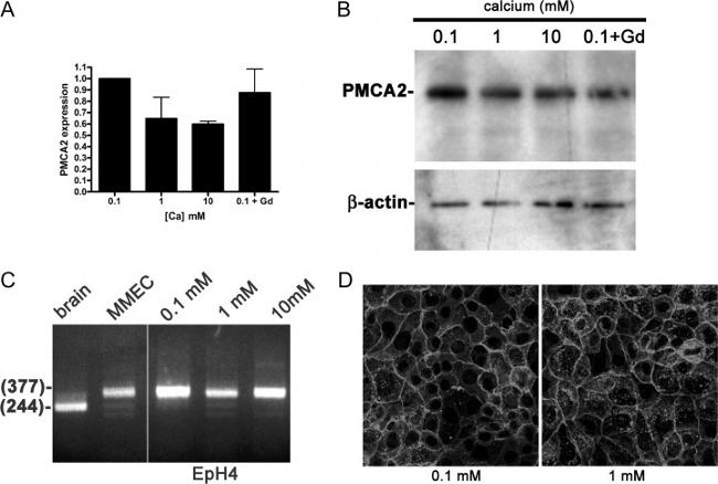 PMCA2 ATPase Antibody in Western Blot, Immunocytochemistry (WB, ICC/IF)