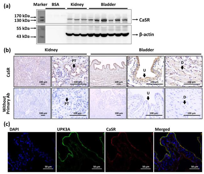 Calcium Sensing Receptor Antibody in Western Blot, Immunohistochemistry (WB, IHC)