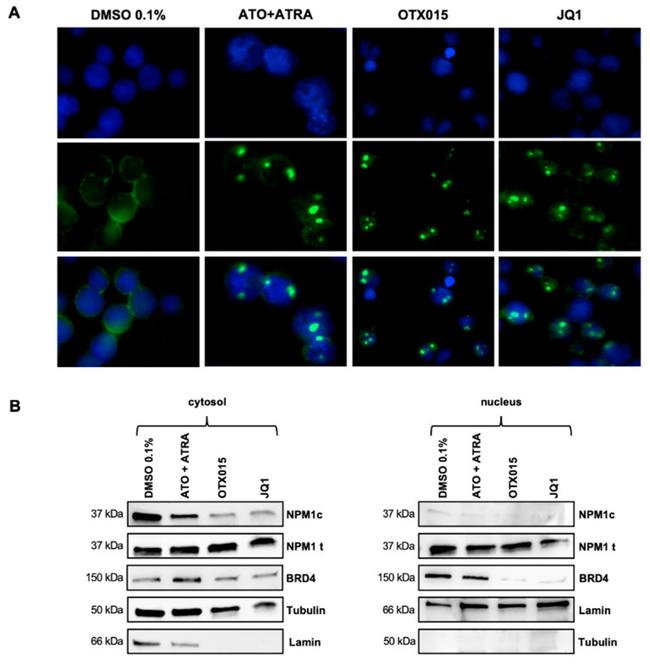 NPM1 (mutant) Antibody in Western Blot, Immunocytochemistry (WB, ICC/IF)