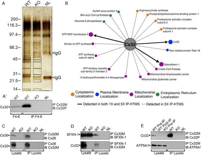 Connexin 32 Antibody in Western Blot, Immunoprecipitation (WB, IP)