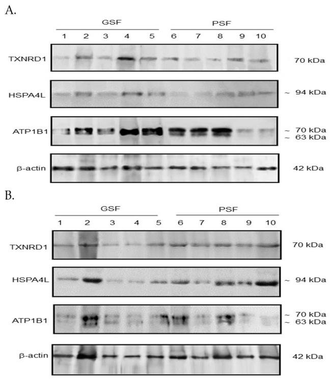 HSPA4L Antibody in Western Blot (WB)