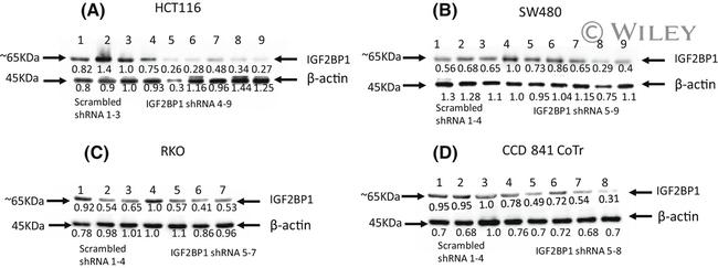 IGF2BP1 Antibody in Western Blot (WB)