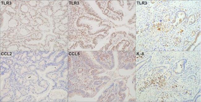 IL-8 (CXCL8) Antibody in Immunohistochemistry (IHC)