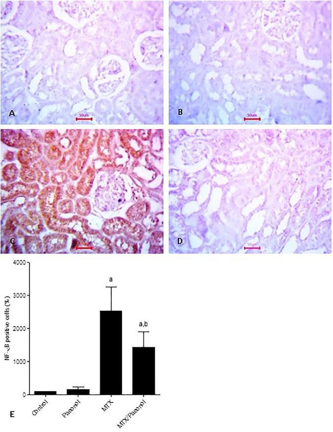 Acetyl-NFkB p65 (Lys310) Antibody in Immunohistochemistry (IHC)